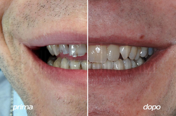 caso 2 sorriso