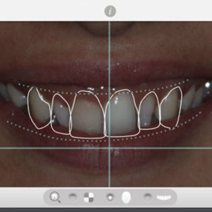 smile design dettaglio studio