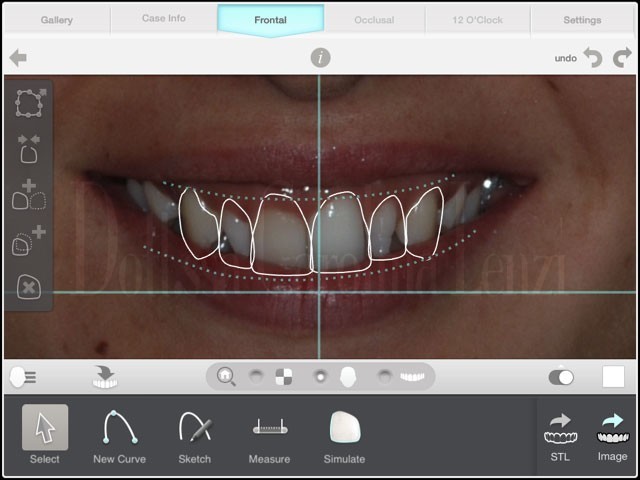 lavoro smile design 