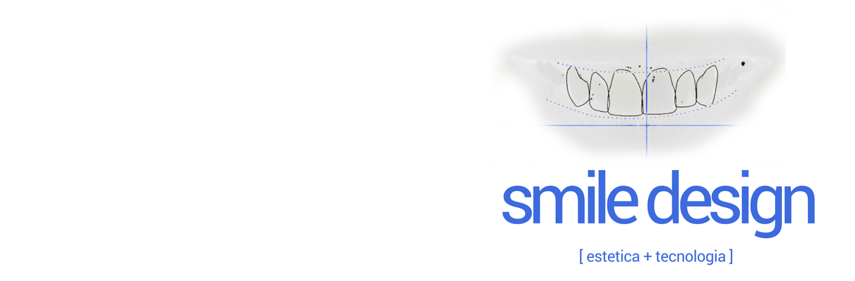 slider smile design